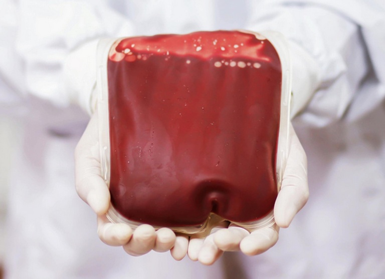 Grupi më i rrallë i gjakut në botë, e kanë vetëm 43 persona